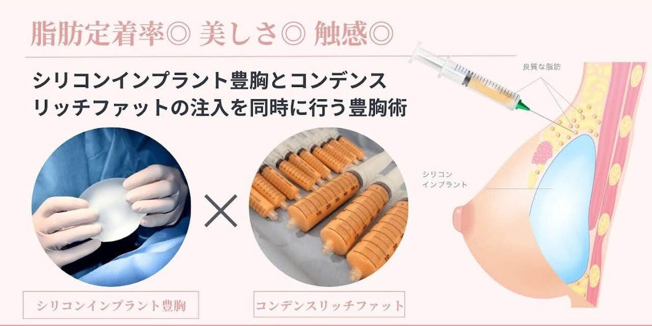 ハイブリッド豊胸とは