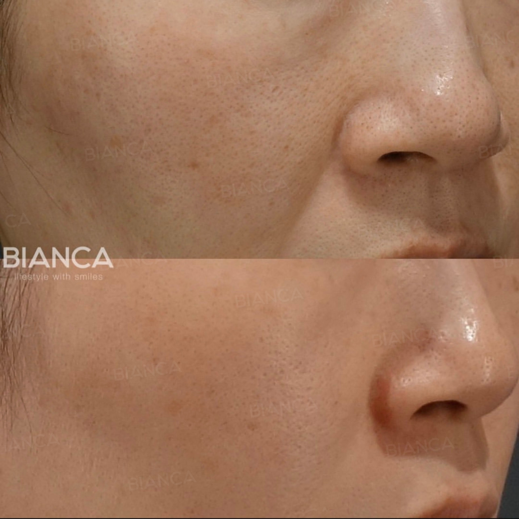 ポテンツァ（マックーム）