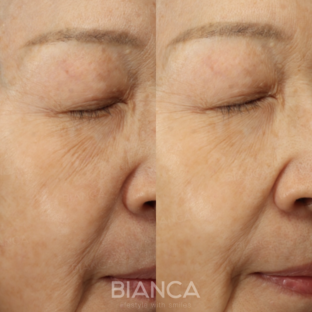 ゴウリ（GOURI）