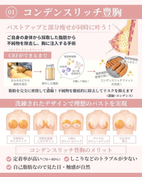コンデンスリッチ豊胸｜銀座・表参道にあるBIANCA CLINIC ビアンカクリニック｜美容外科・美容皮膚科・再生医療・美容婦人科・美容内科・医療アートメイク