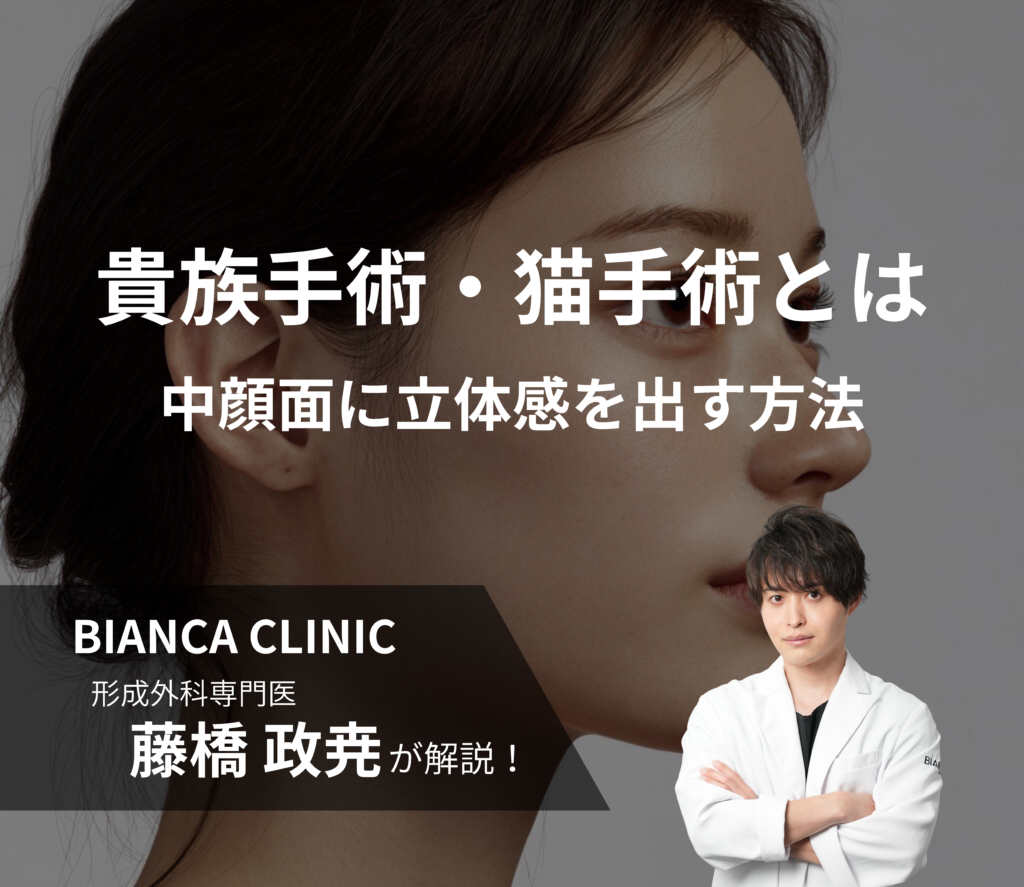 貴族手術・猫手術とは｜中顔面を持ち上げる手術とは何をしているのか