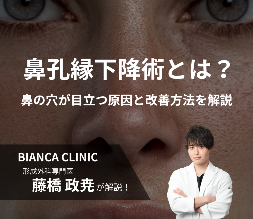 鼻孔縁下降術とは？｜鼻の穴が目立つ原因と改善方法を解説