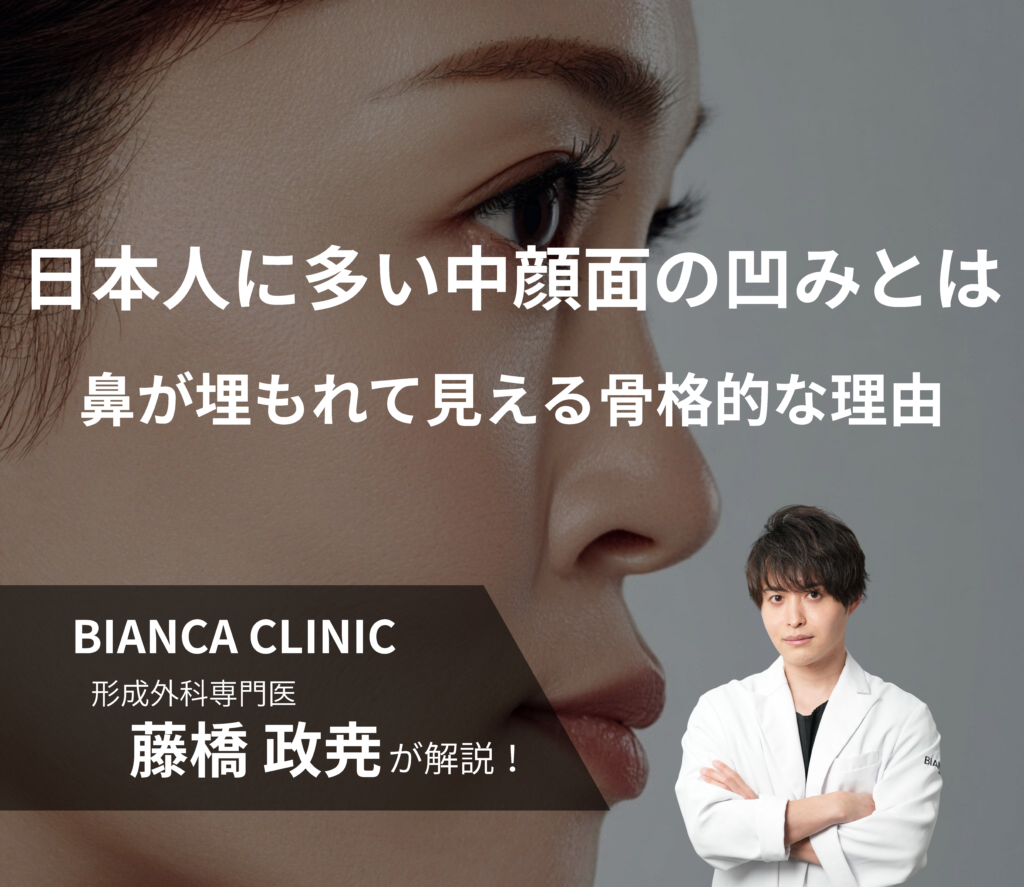 日本人に多い中顔面の凹みとは｜鼻が埋もれて見える骨格的な理由