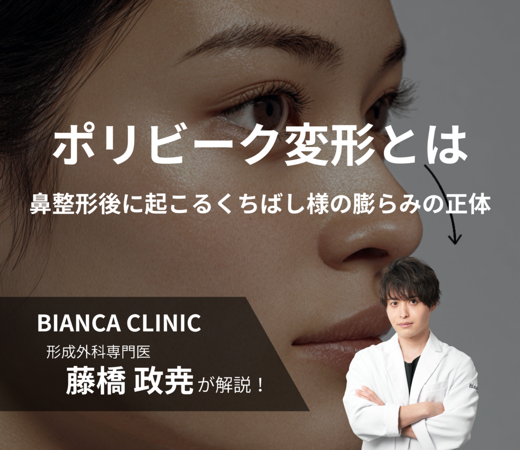 ポリビーク変形とは｜鼻整形後に起こるくちばし様の膨らみの正体