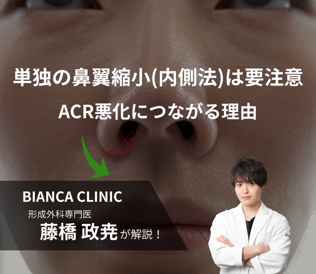 単独の鼻翼縮小（内側法）は要注意｜ACR悪化につながる理由