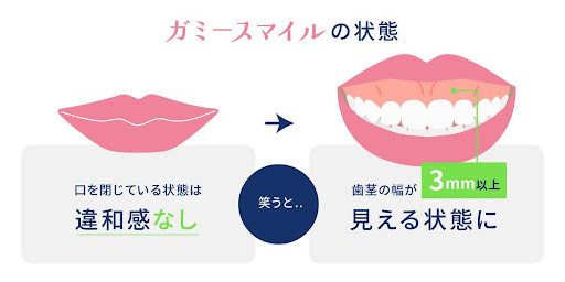 つきやま歯科医院｜ビアンカ銀座｜日本を代表する美容健康再生医療のクリニック