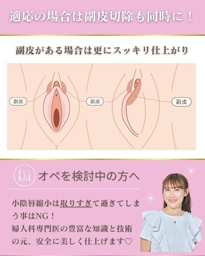 小陰唇縮小やクリトリス包茎との同時施術が可能