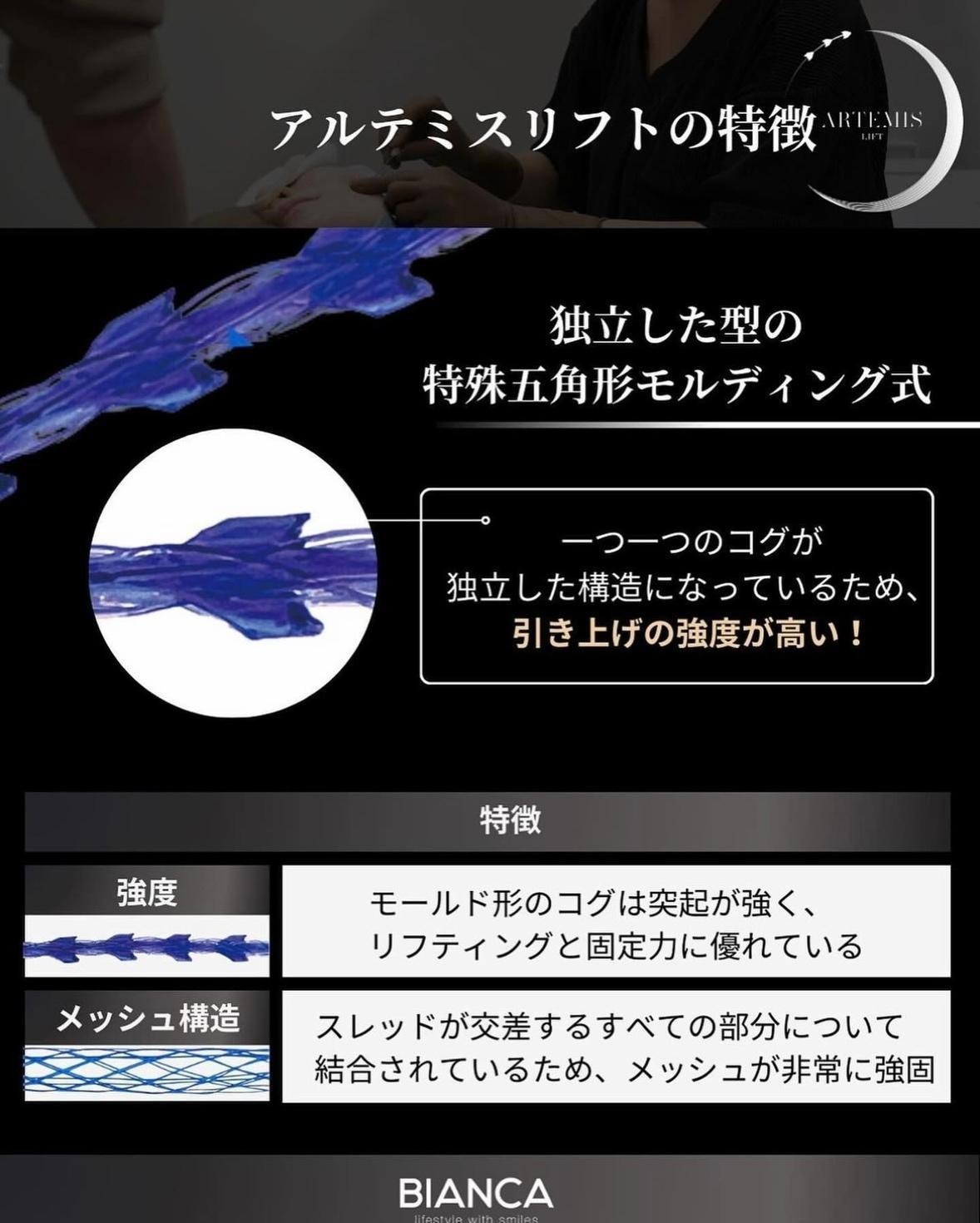 高い引き上げ力がアルテミスリフトの特徴