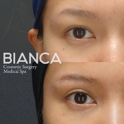 二重ラインを目立たせて魅力的な目元に<br />