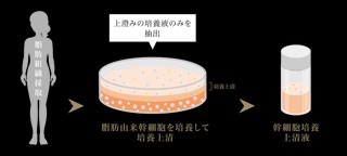 厳しい品質管理のもとに作られている純国産の浄化濃縮幹細胞培養上清液を使用