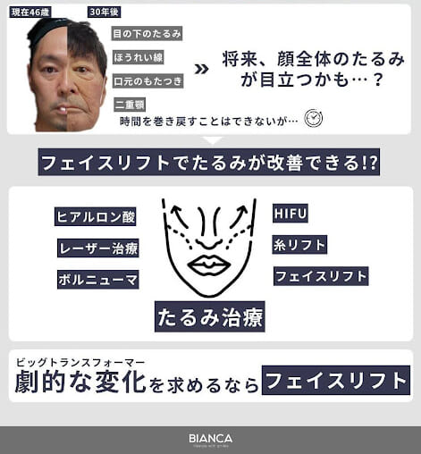 長期的な効果が得られるエイジングケア