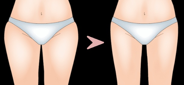 部分痩せとバストアップを両方実現できる