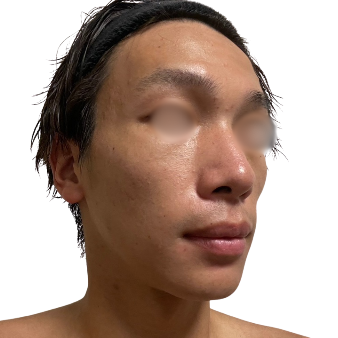 トライフィルプロ