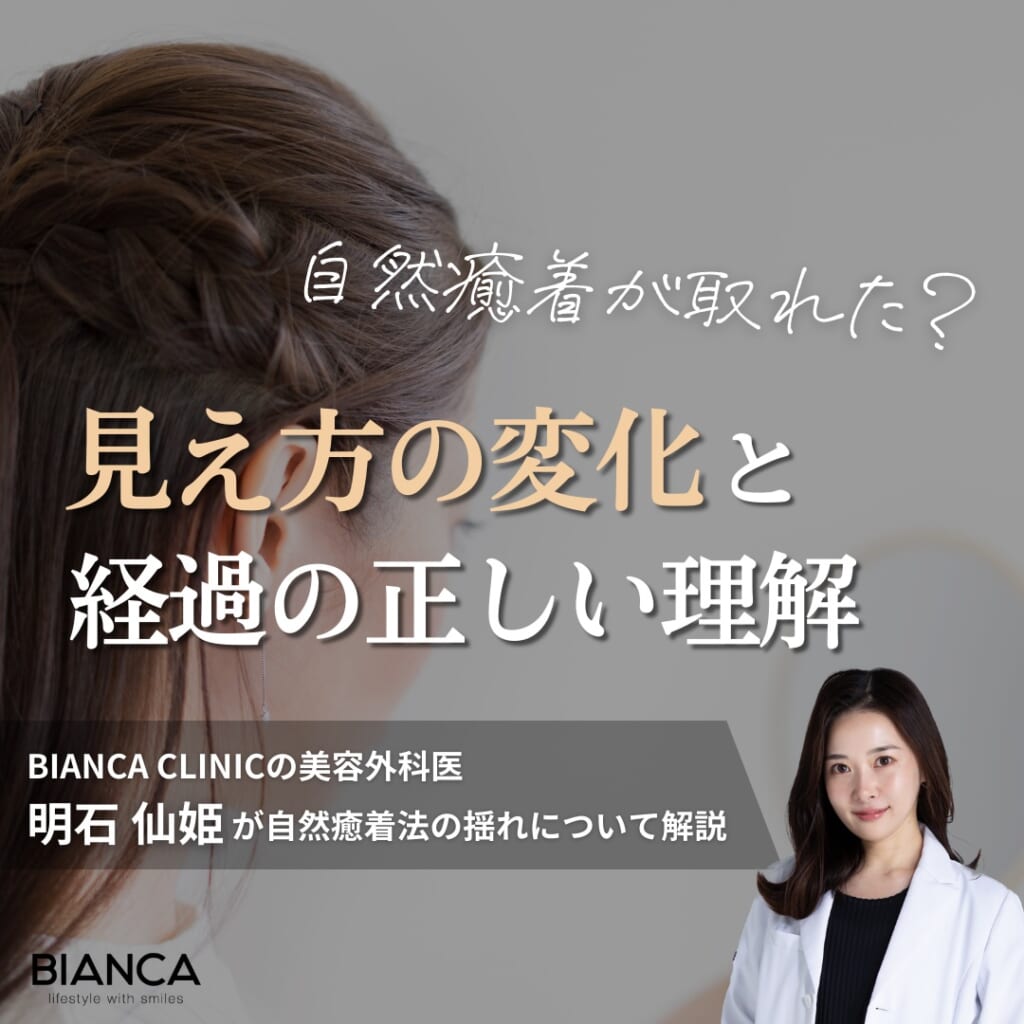 自然癒着法が「取れたかも…」と感じる理由とは？見分け方と相談のタイミングを明石 仙姫が解説