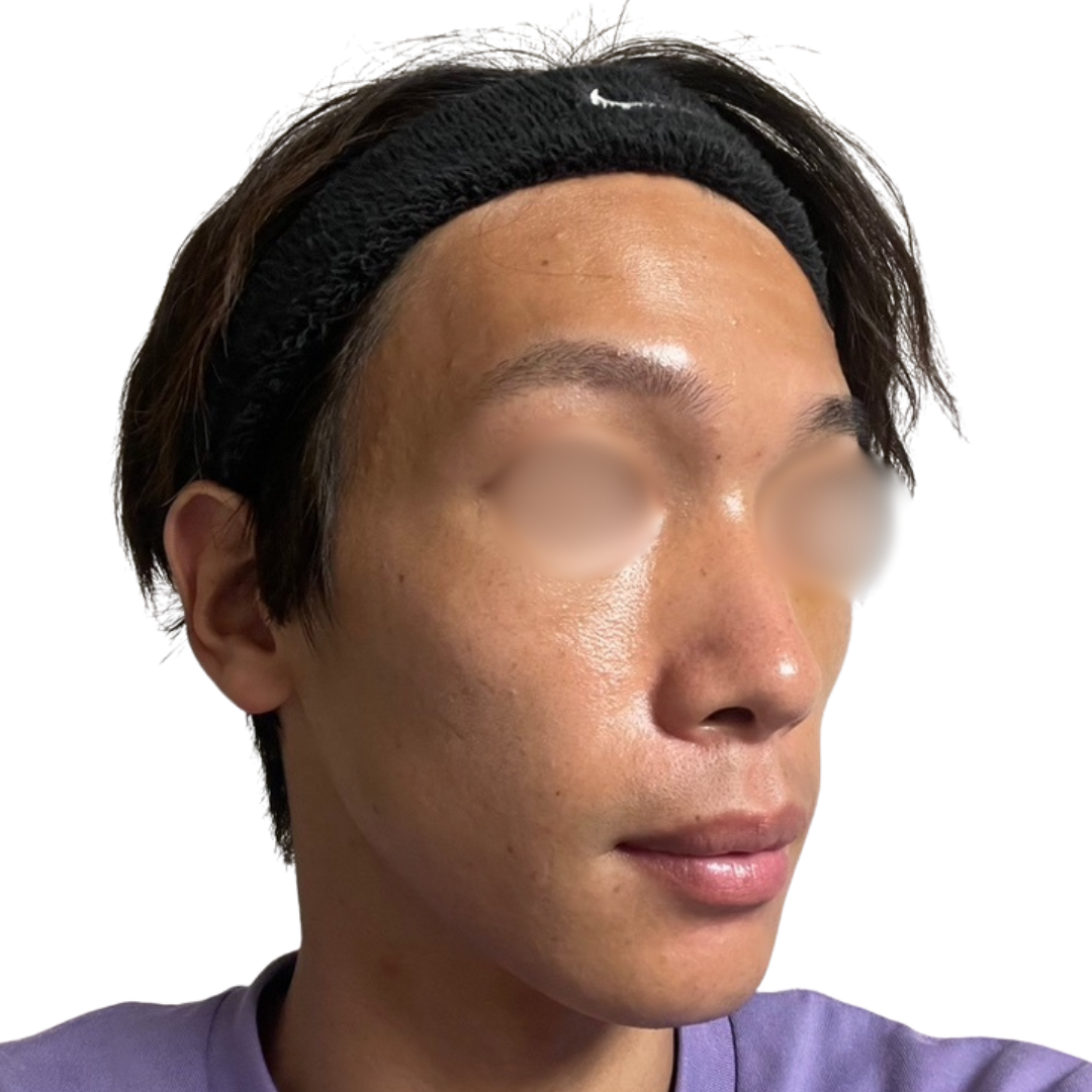 トライフィルプロ