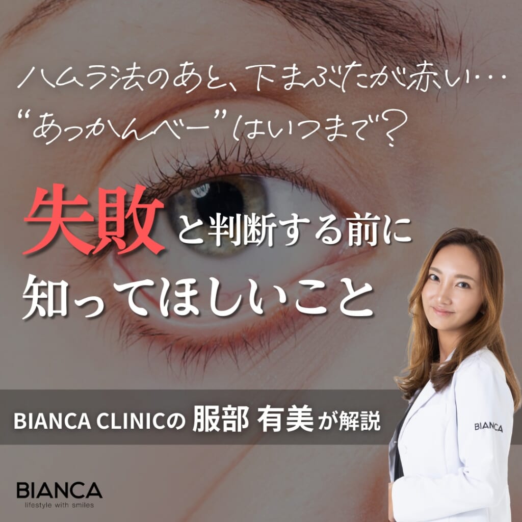ハムラ法で目元が“あっかんべー”に？術後の変化と回復のポイントを専門医が解説