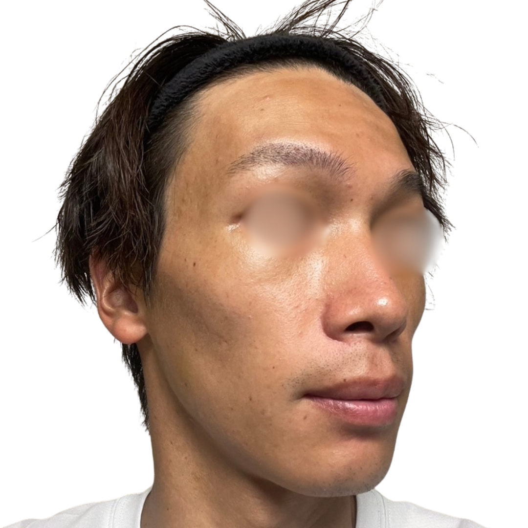 トライフィルプロ