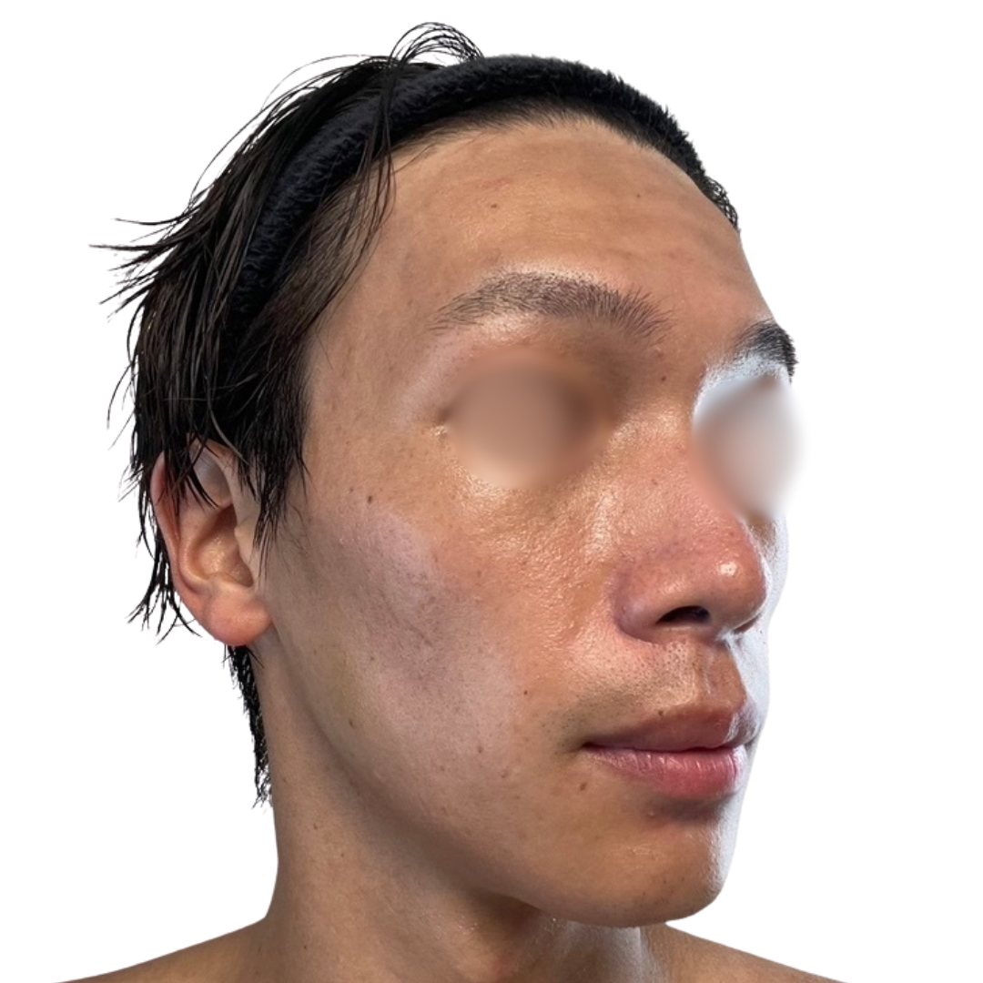 トライフィルプロ