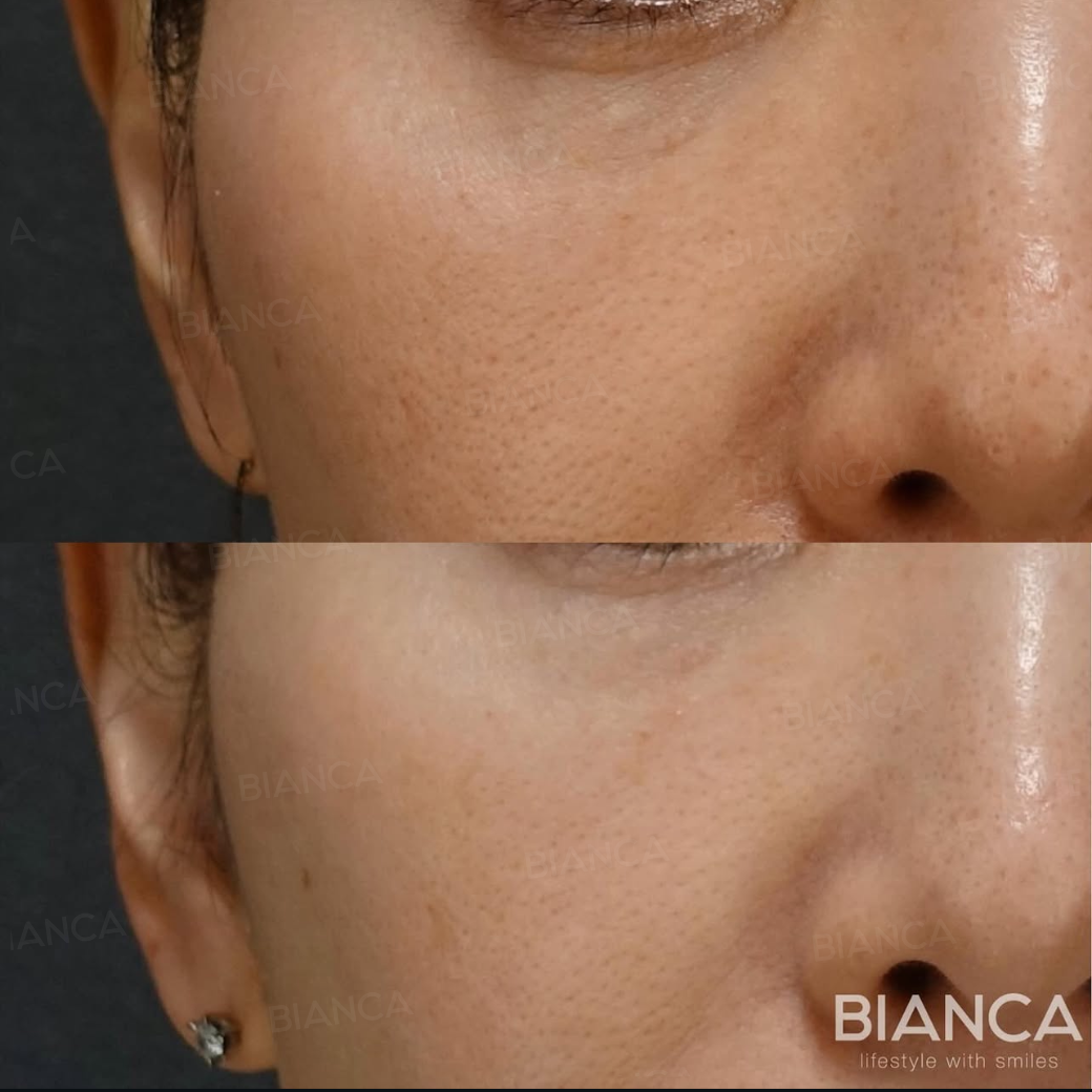 リジュラン・ジュベルック 