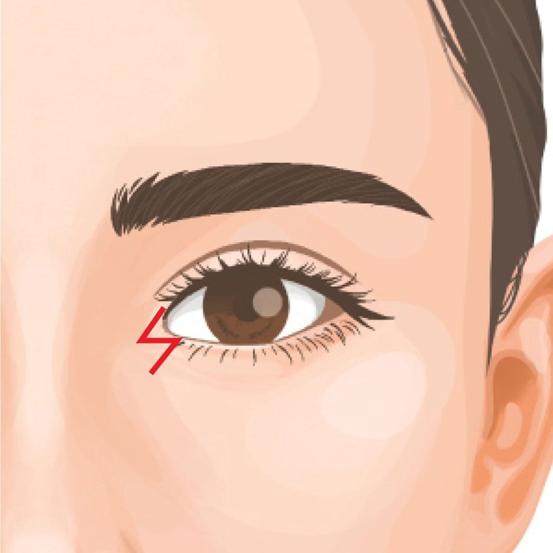 一人ひとりの目元に合った術式を選択