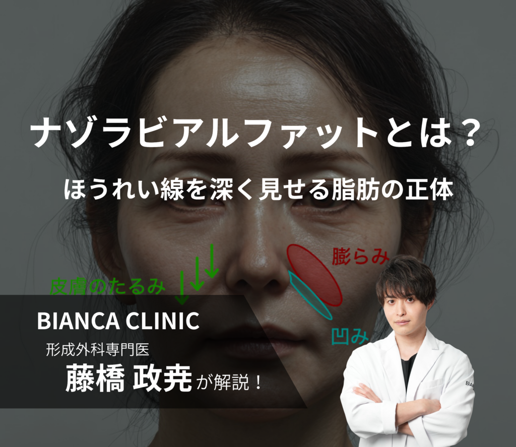 ナゾラビアルファットとは？｜ほうれい線を深く見せる脂肪の正体