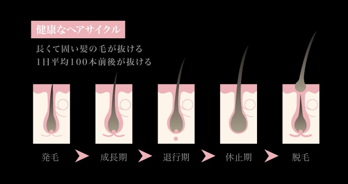 女性男性型脱毛症（FAGA）の特徴とメカニズム
