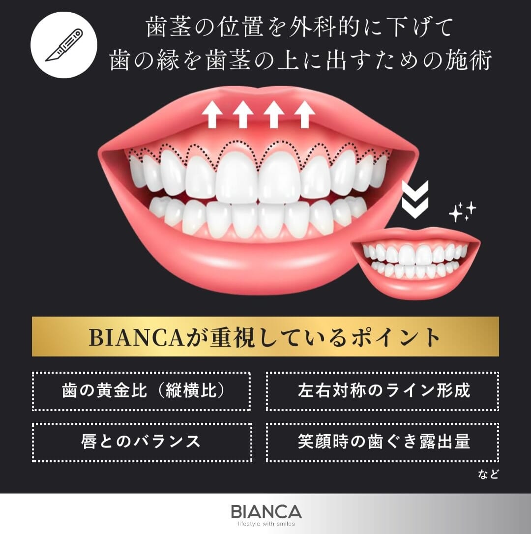 審美的歯冠長延長術とは