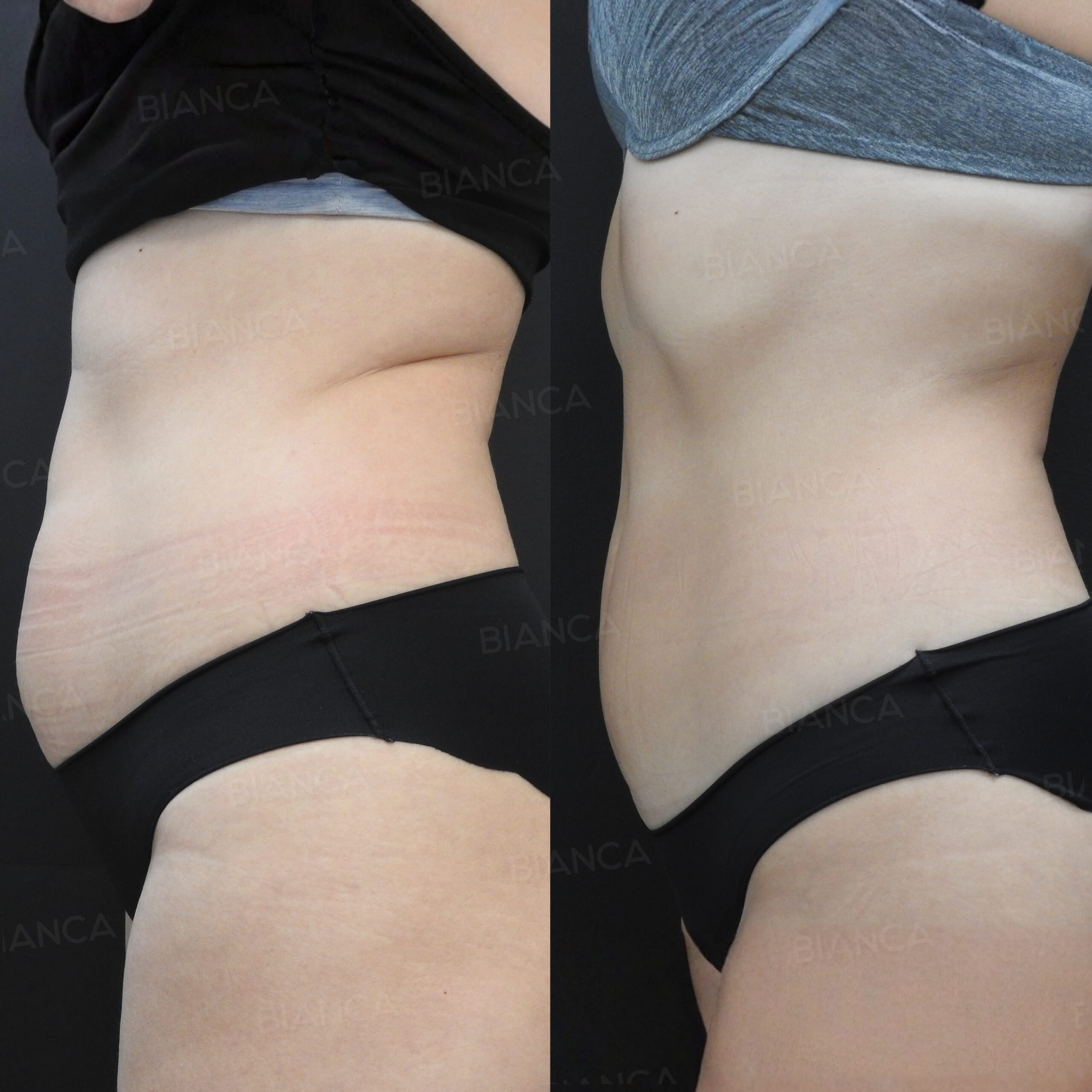 AlmaPrimeX (ボディ)