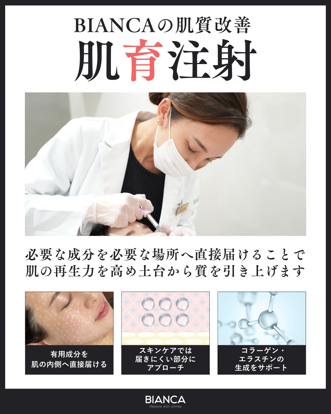 スキンブースターとは