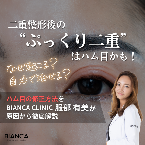 ハム目の修正方法は?なぜ起こる?医師が原因別にわかりやすく解説