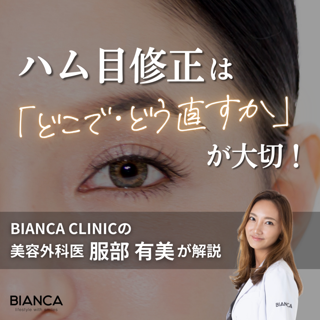 ハム目修正は韓国が正解？やり直しで後悔しないための修正方法を美容外科医が解説