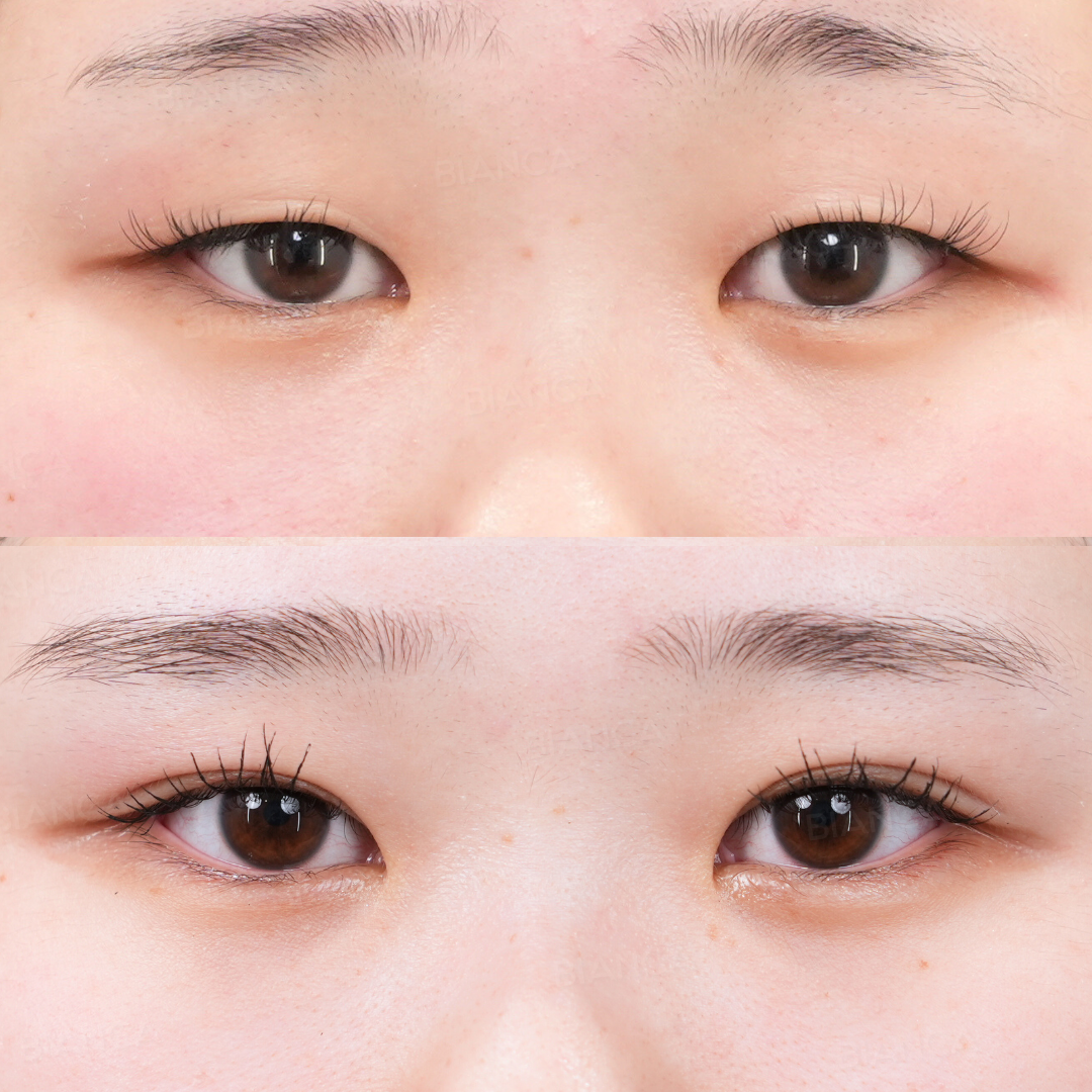 二重埋没（B TWICE）