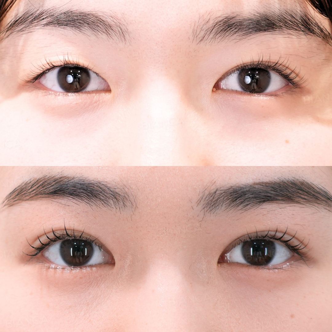 二重埋没（B TWICE）