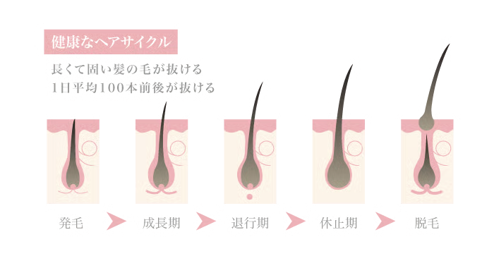 女性男性型脱毛症（FAGA）の特徴とメカニズム