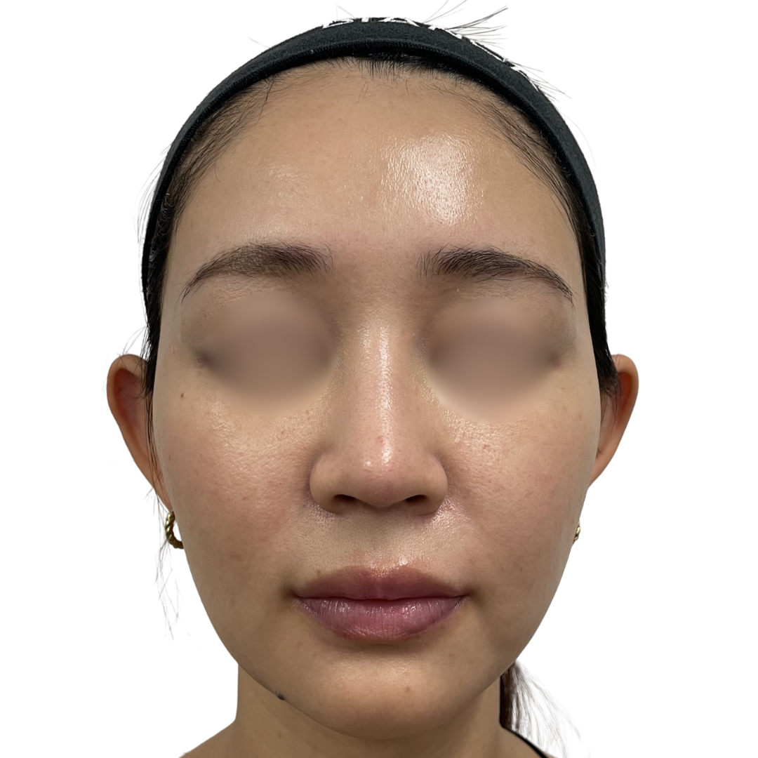 モフィウス8バースト