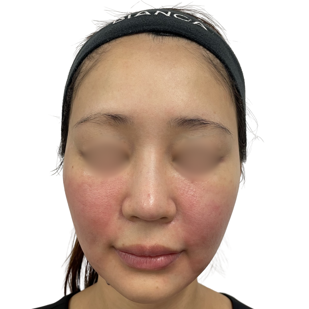 モフィウス8バースト