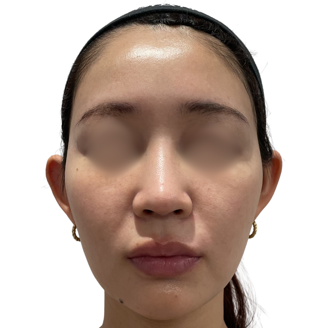 モフィウス8バースト