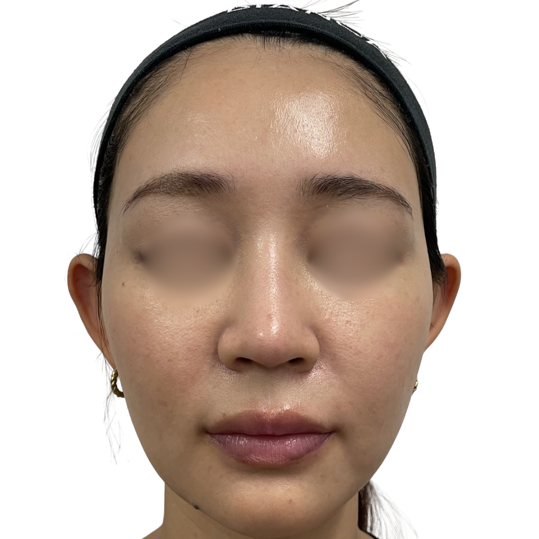 モフィウス8バースト