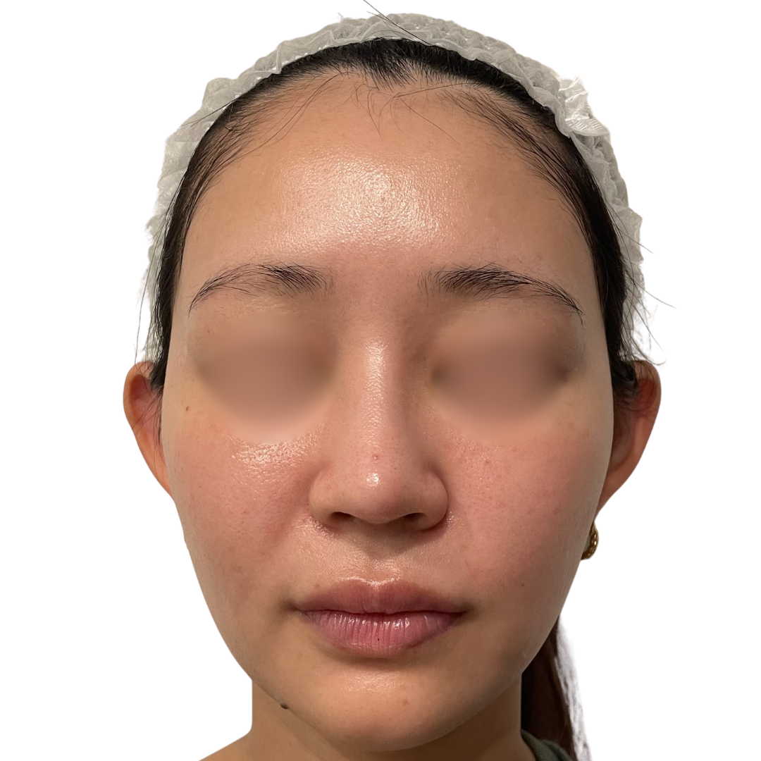 モフィウス8バースト