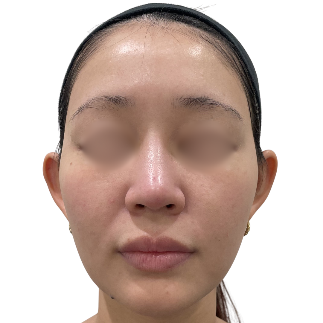 モフィウス8バースト