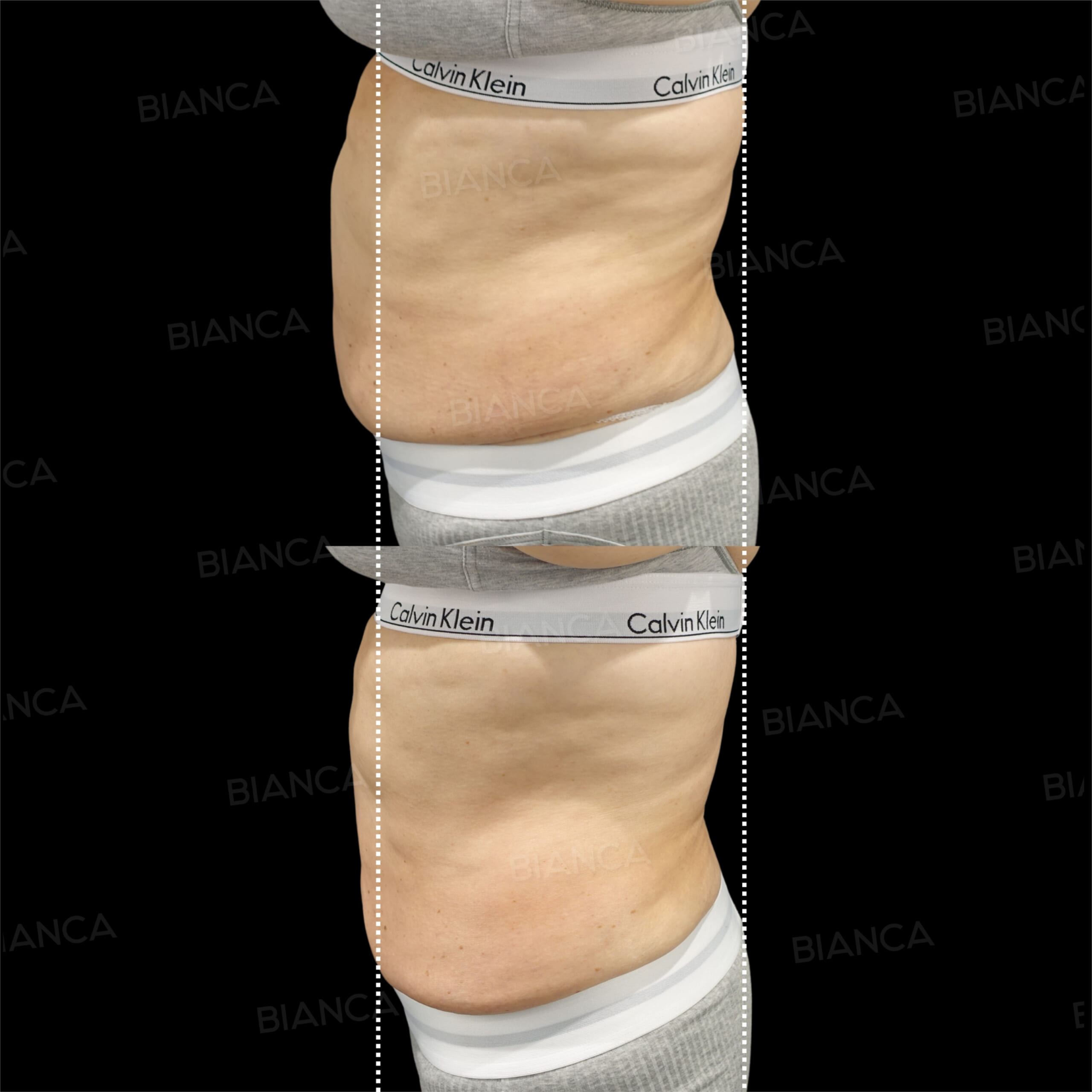 AlmaPrimeX(ボディ)