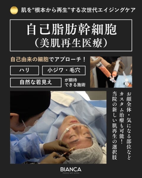 ビューティフィル脂肪注入｜銀座・表参道にあるBIANCA CLINIC ビアンカクリニック｜美容外科・美容皮膚科・再生医療・美容婦人科・美容内科