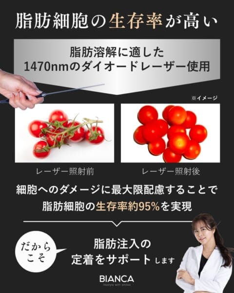 ビューティフィル脂肪注入｜銀座・表参道にあるBIANCA CLINIC ビアンカクリニック｜美容外科・美容皮膚科・再生医療・美容婦人科・美容内科