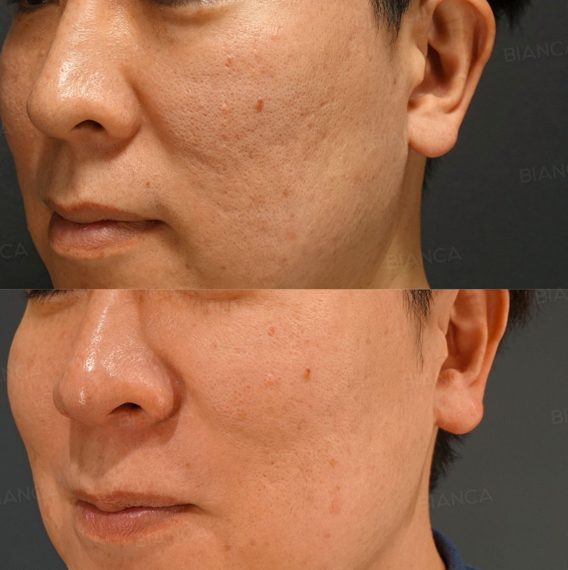 トライフィルプロ