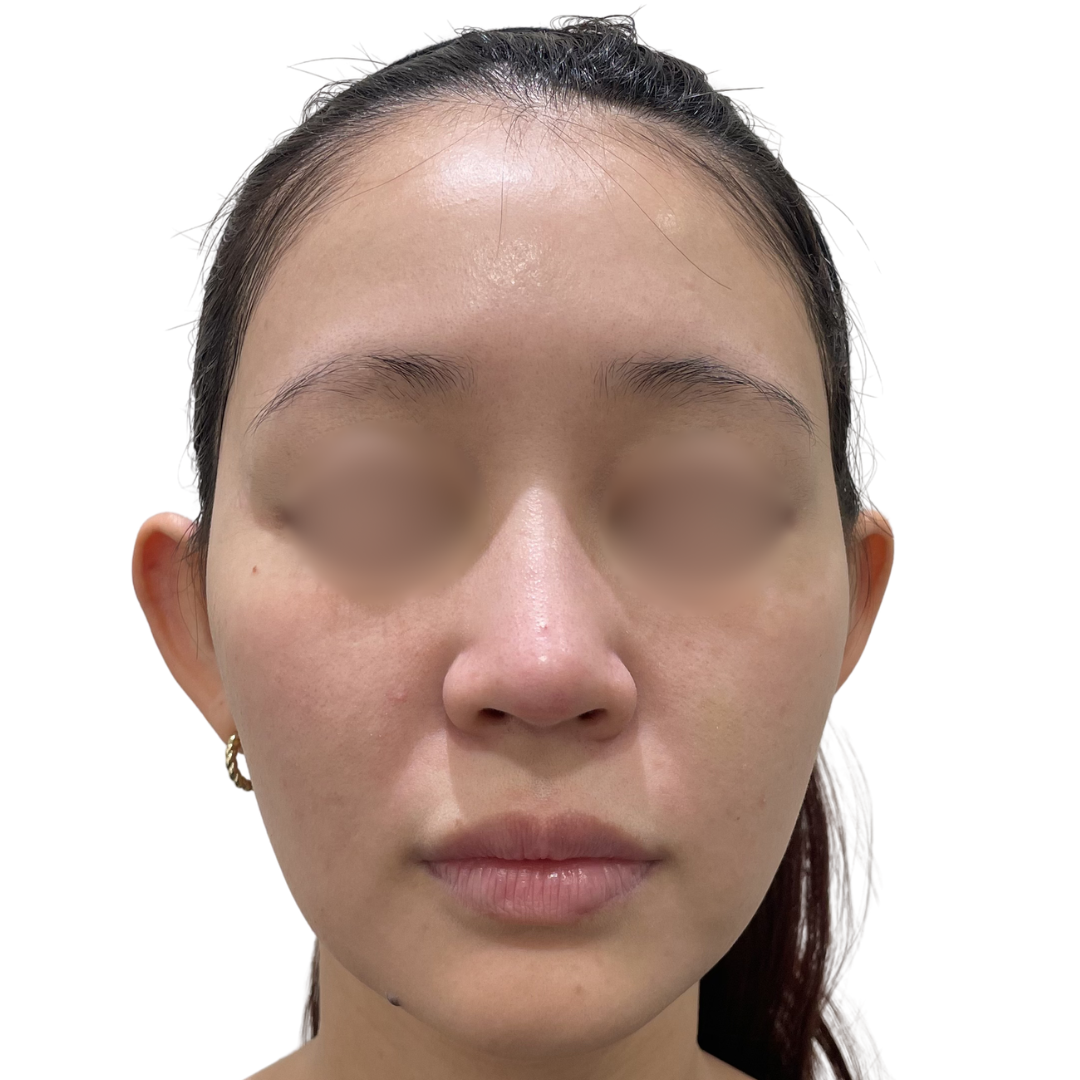 モフィウス8バースト