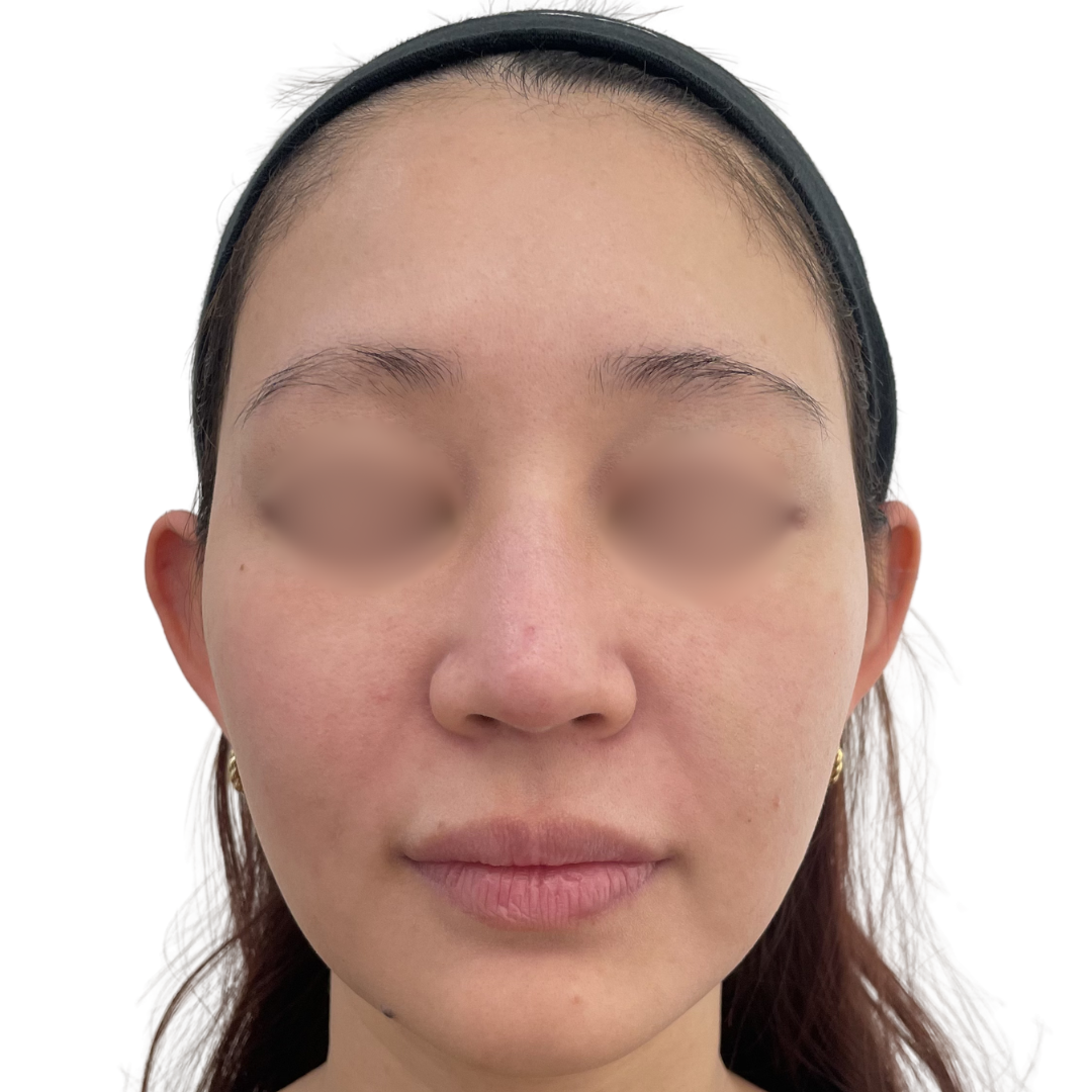 モフィウス8バースト