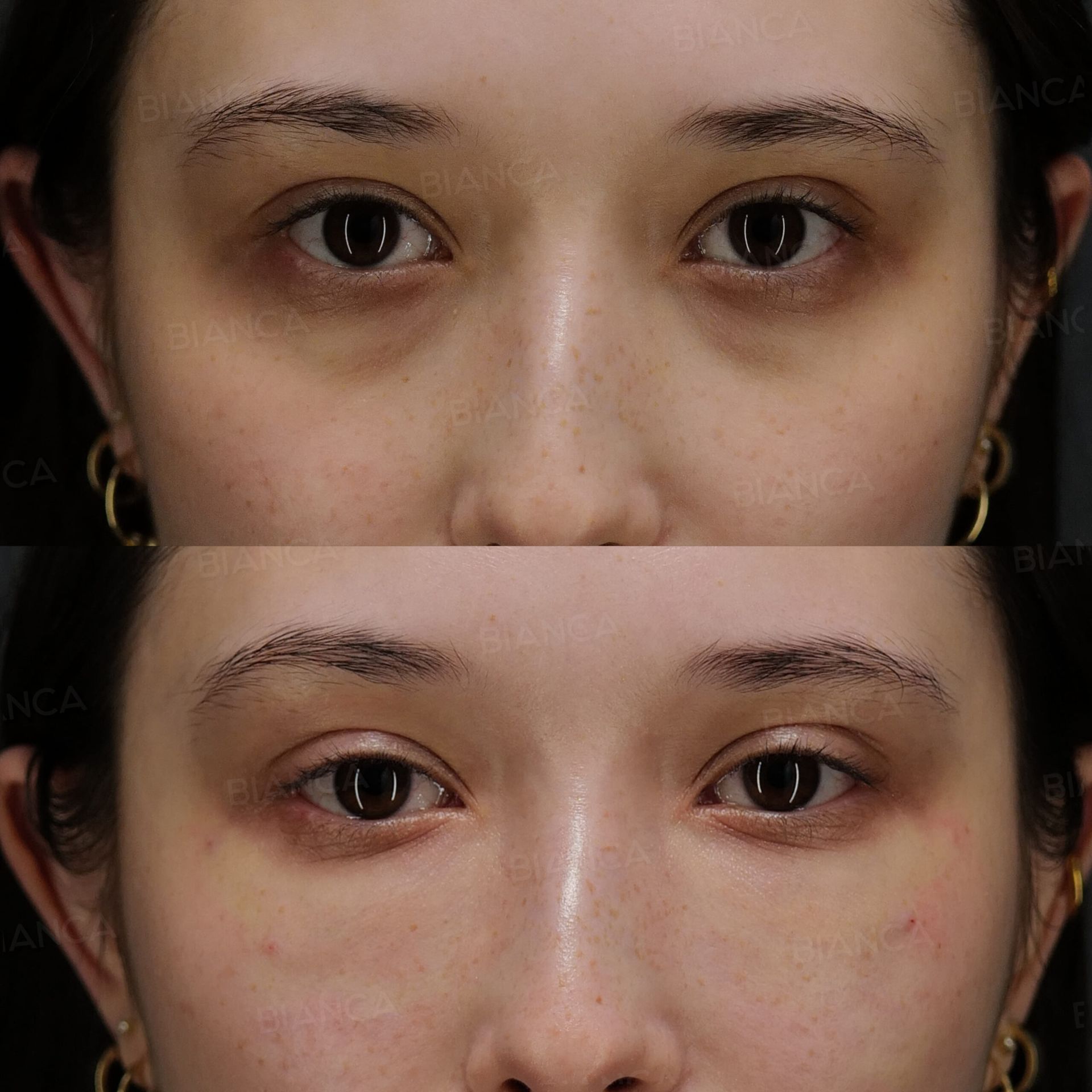 ベビーコラーゲン