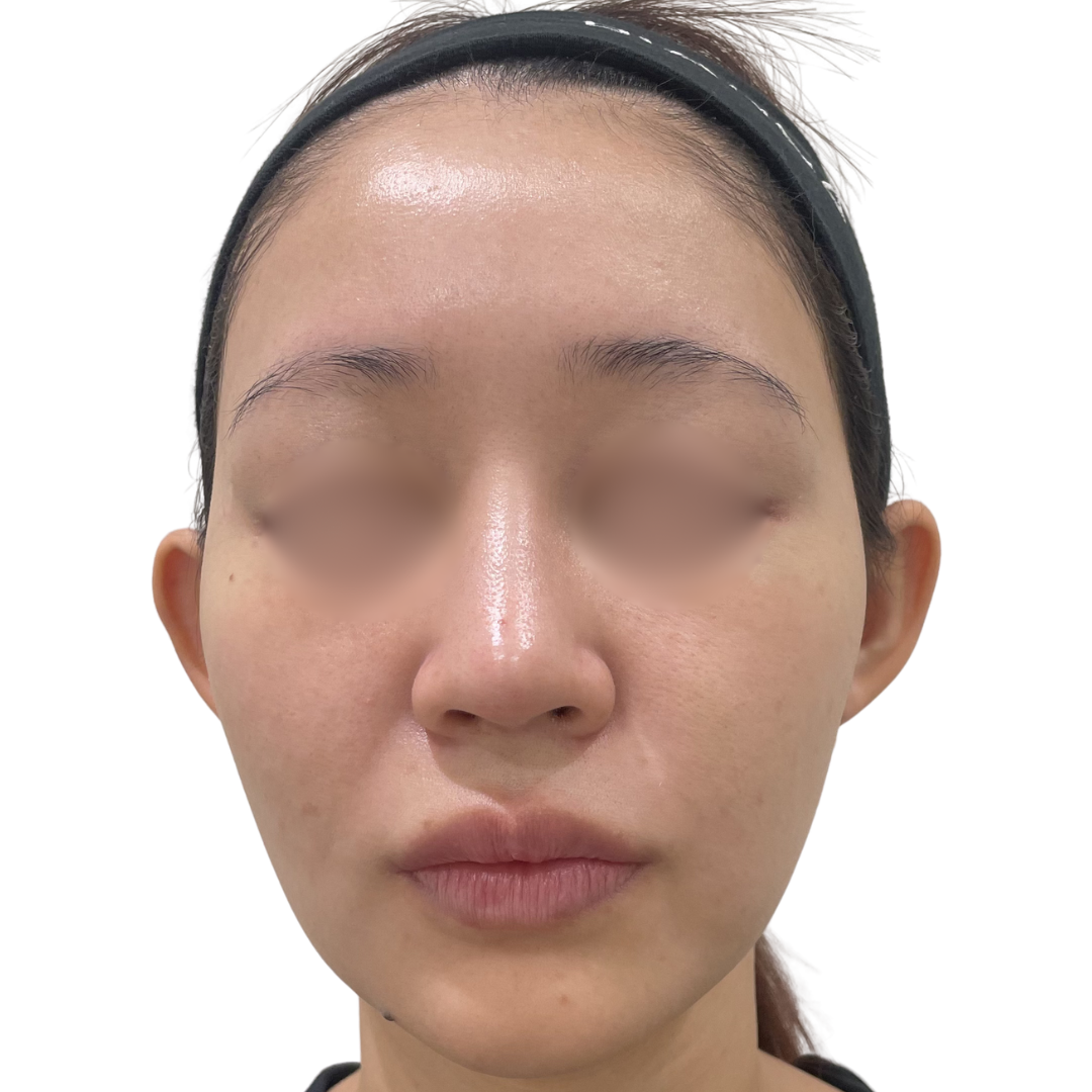 モフィウス8バースト