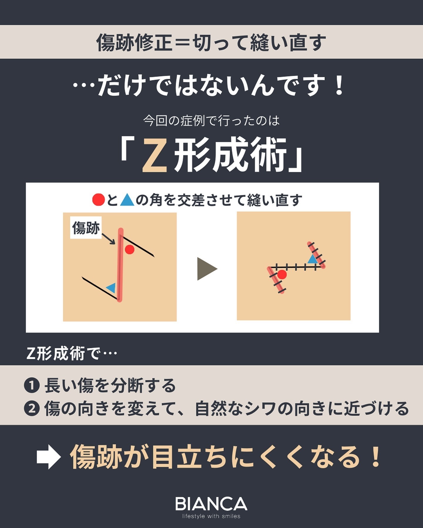 傷跡修正（外科手術）の方法