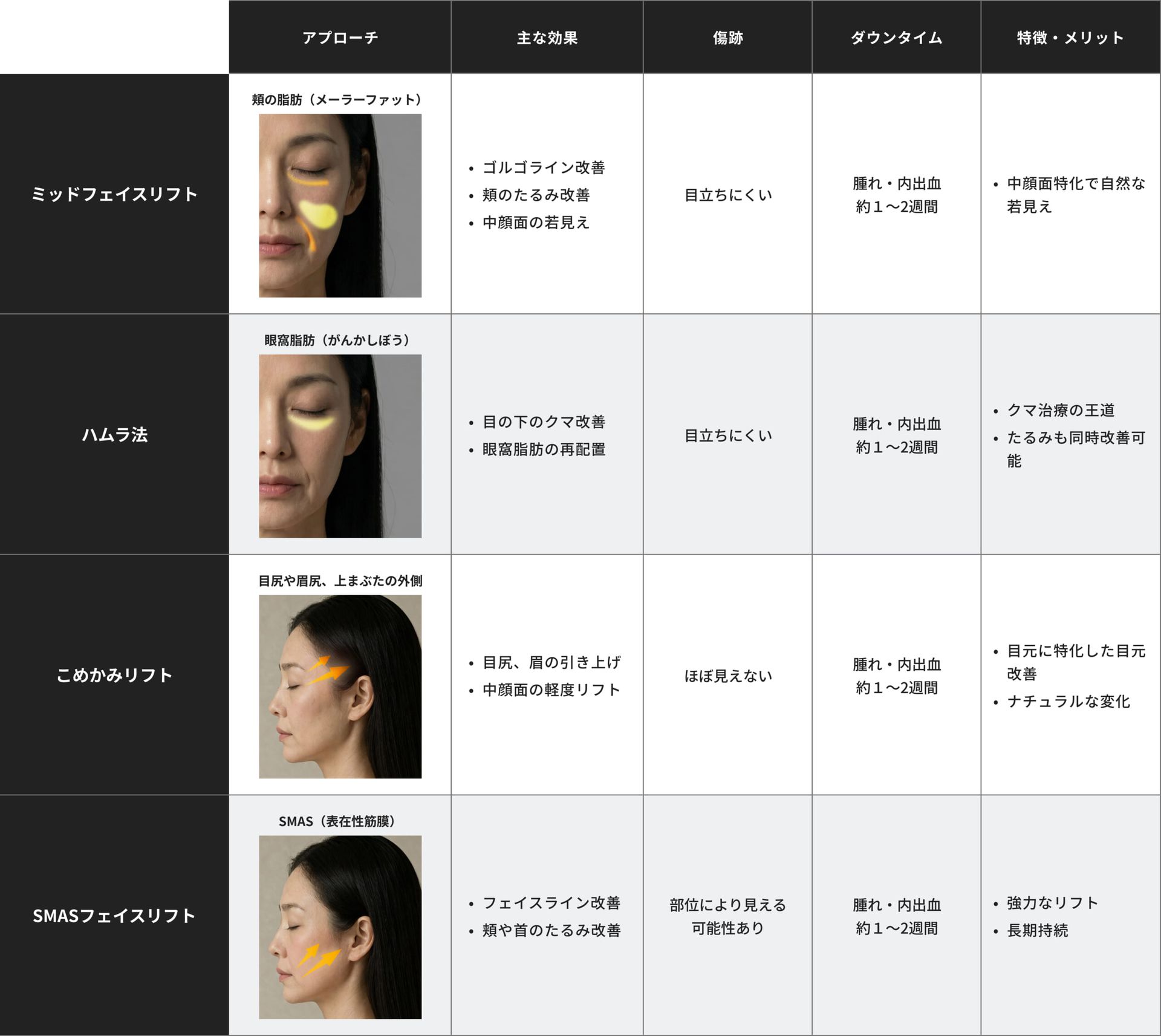 ミッドフェイスリフト・ハムラ法・こめかみリフト・デュアルプレーンミッドフェイスリフトの違い